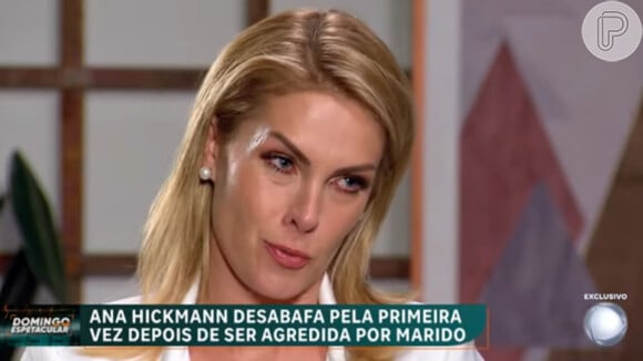 Ana Hickmann revelou que se não fosse seu cachorro Joaquim ela não sabe como teria 'escapado' do descontrole de Alexandre Correa