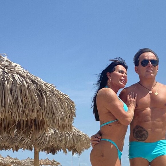 Gretchen é adepta a um procedimento que chama "Bumbum na nuca" que consiste na aplicação de injeções pra preencher determinadas áreas dos glúteos