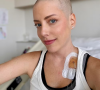 Fabiana Justus surge com cabelo raspado durante tratamento contra o câncer