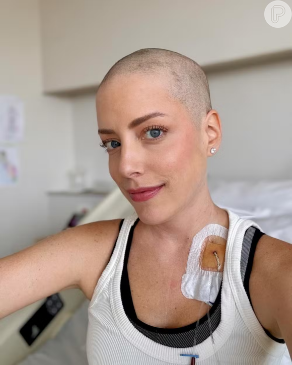 Fabiana Justus surge com cabelo raspado durante tratamento contra o câncer