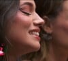 'BBB 24': 'Plaquinhas' nos dentes de Alane ficaram visíveis nas câmeras da TV Globo