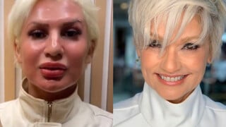 Romagaga ou Andréa Nóbrega? Influenciadora faz peeling de fenol, transforma o rosto e web aponta semelhança