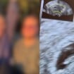 Vem bebê aí! Casal de 'Casamento às Cegas' anuncia gravidez do 1º filho e anima internautas: 'Surpresa'