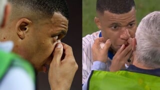 Bizarro! Mbappé fica com nariz 'torto' e ensanguentado após se chocar com outro jogador: 'Igual a um L'