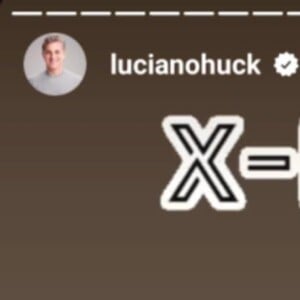 Luciano Huck mostra resultado de raio-x