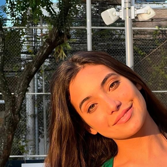 Vanessa Lopes, que causou polêmica com sua passagem pelo 'BBB 24', está enfrentando crises de acne no rosto