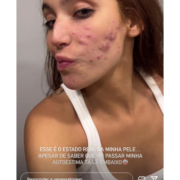 Vanessa Lopes disse estar fazendo tratamento há 27 dias, mas ainda não ter visto resultado