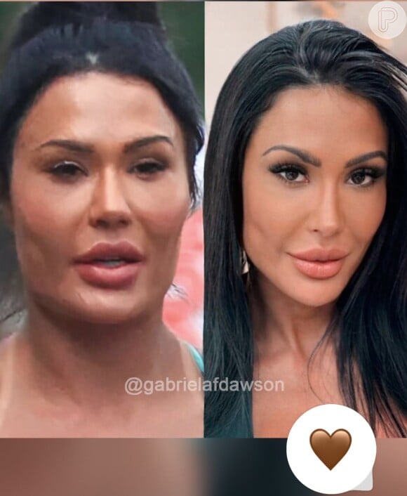 O antes e depois de Gracyanne Barbosa impressiona!