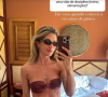 Ex-BBB Aline Gotschalg passou por uma mudança drástica em seu corpo e contou nas redes sociais sua motivação 