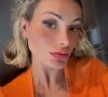 Andressa Urach já bifurcou a língua e tatuou sardas no rosto