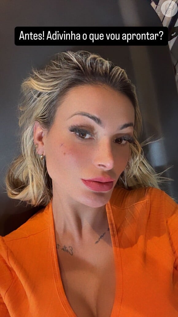 Andressa Urach já bifurcou a língua e tatuou sardas no rosto