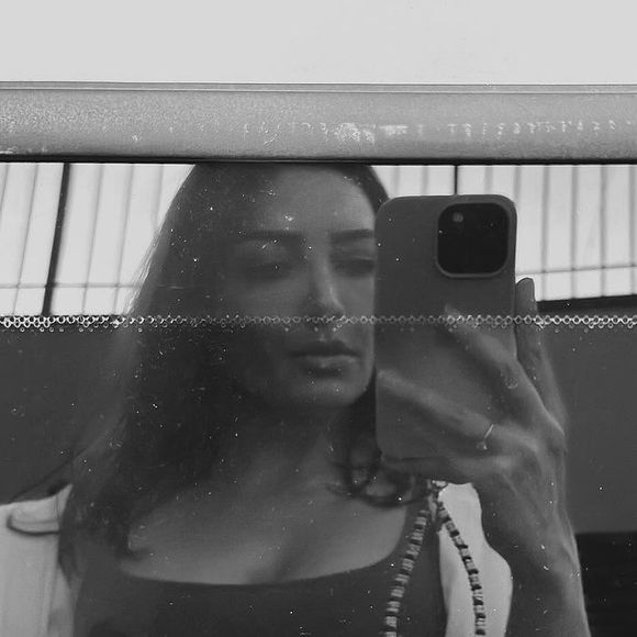 Prótese de Tainá Galvão explodiu após uma queda da cantora enquanto esquiava em Aspen