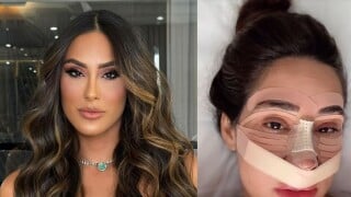 Lembra dela? Ex-BBB 24 Deniziane gasta R$ 40 mil com rinoplastia e resultado vai te impressionar: 'Mesmo inchado dá para ver'