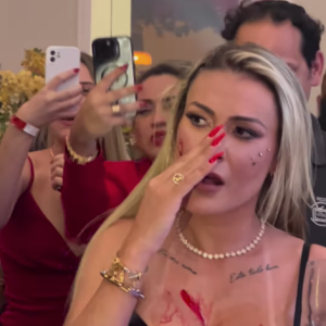 Andressa Urach não foge de brigas e, recentemente, teve seu rosto cortado por Juju Ferrari durante uma confusão em uma festa