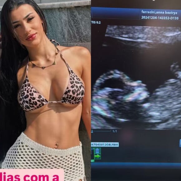 Bia Miranda exibe barriga chapada, mas mostra ultrassom para comprovar 3 meses de gravidez: 'Minha genética é assim'