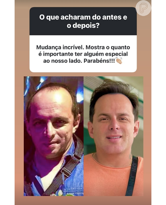 Mudança do marido de Gretchen rendeu muitos elogios de fãs, que ficaram chocados com o resultado