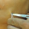 Uma tesourinha é utilizada para eliminar algumas bolhas que surgem no processo de maquiagem