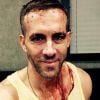 Ryan Reynolds divulgou uma foto com o rosto manchado de sangue cenográfico durante as filmagens de 'Deadpool'