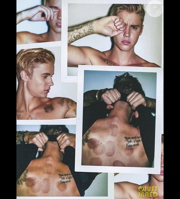 Justin Bieber aparece com marcas pelo corpo em ensaio sensual para a revista 'Interview'
