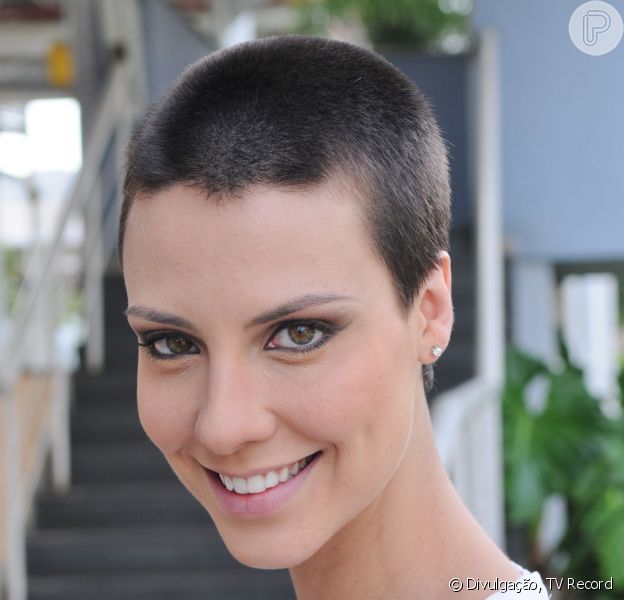 Atriz De Os Dez Mandamentos Camila Rodrigues Usa Gesso Apos Cirurgia Na Mao Purepeople