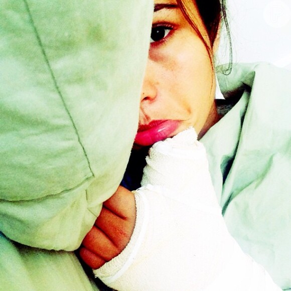 Nanda Costa quebrou a escafoide, osso da mão, na última quinta-feira, 24 de outubro de 2013. A atriz compartilhou uma foto no Instagram