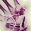 No Instagram, Nanda Costa compartilhou uma foto do raio-x da mão após a cirurgia: 'Entrei na faca. Agora tenho um parafuso a mais pra apertar!'