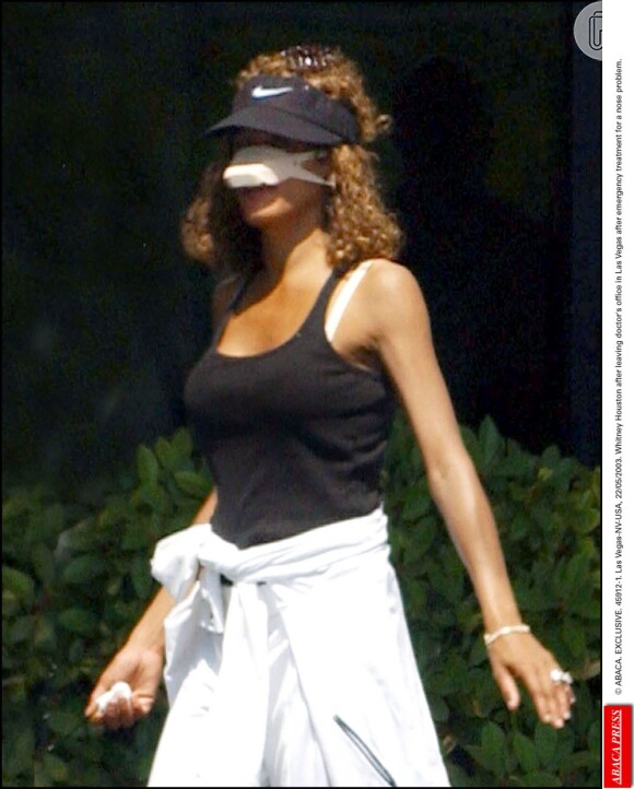 Em 2003, Whitney apareceu com um curativo saindo de um consultório médico após 'um problema emergencial no nariz'