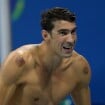 Entenda bolas vermelhas no corpo de Michael Phelps para amenizar dor na Rio 2016