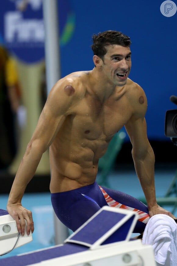Michael Phelps está com manchas vermelhas pelo corpo porque, antes de competir na Olimpíada Rio 2016, recorre a uma técnica chamada ventosa para amenizar a dor