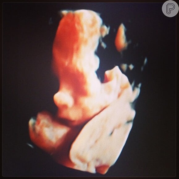 Ana Hickmann compartilha imagem da ultrassonografia 3D do filho, Alexandre: 'O nariz mais perfeito da mamãe, a boca mais gostosa, o baby mais lindo!'