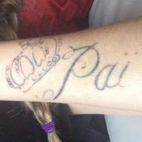 Bárbara Evans comemora avanço em remoção de tatuagem: 'Está saindo'