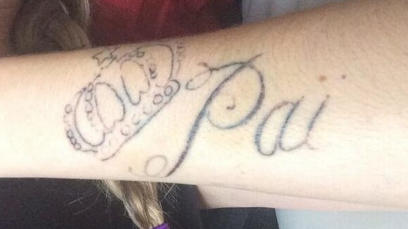 Bárbara Evans comemora avanço em remoção de tatuagem: 'Está saindo'