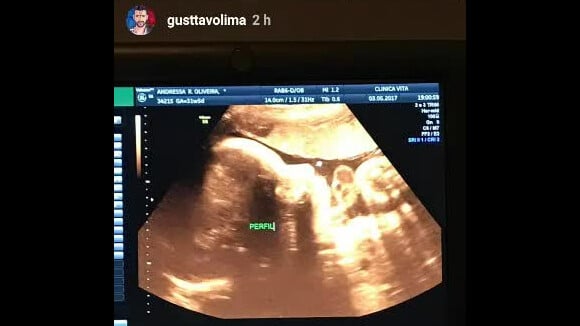 Gusttavo Lima filma ultrassom de seu filho com Andressa Suita nesta quarta-feira, dia 03 de maio de 2017