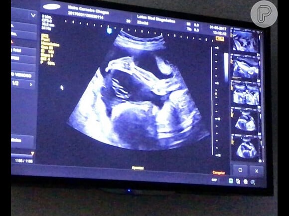 Maíra Charken mostra ultrassonografia do filho, Gael