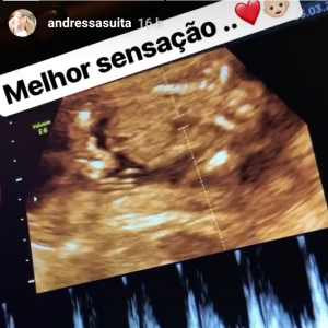 Andressa Suita tem compartilhado cada momento da gestação com seus seguidores nas redes sociais