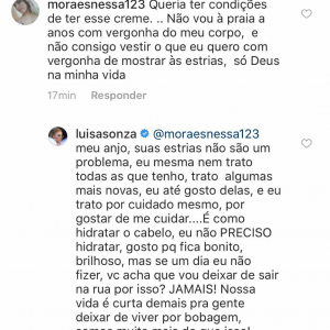 Luísa Sonza rejeitou preocupação com estrias ao responder fã na web