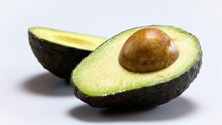 Sofre de enxaqueca? Nutricionista Patricia Davidson lista alimentos para incluir na dieta