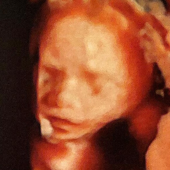 Andressa Suita exibiu novo ultrassom do segundo filho, Samuel