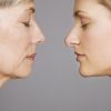 A dermatologista Laíse Leal também esclarece o uso do Botox para miofasciculação. 'Também uso para casos de miofasciculação de face, que são contrações musculares involuntárias'