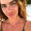 Mariana Goldfarb postou foto sem maquiagem e explicou mancha na área do buço: 'Para quem está falando lá na foto sobre o protetor solar, do melasma, então... Eu tenho, infelizmente, aqui no bigode'