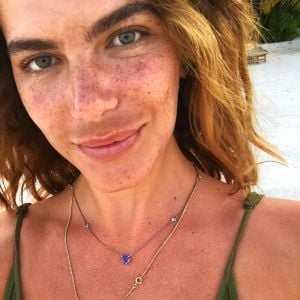 Mariana Goldfarb postou foto sem maquiagem e explicou mancha na área do buço: 'Para quem está falando lá na foto sobre o protetor solar, do melasma, então... Eu tenho, infelizmente, aqui no bigode'