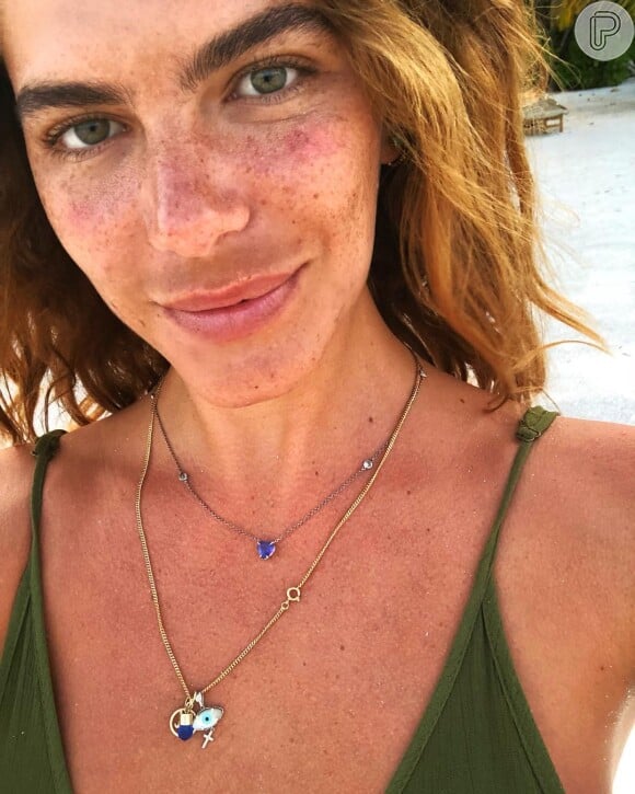 Mariana Goldfarb postou foto sem maquiagem e explicou mancha na área do buço: 'Para quem está falando lá na foto sobre o protetor solar, do melasma, então... Eu tenho, infelizmente, aqui no bigode'