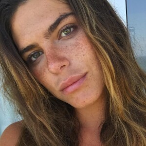 'A minha pele tem pré disposição a ter sarda, então é o tipo de pele mesmo. Mas eu cuido, só que eu não quero apagar as minhas sardas', declarou Mariana Goldfarb sobre melasma no rosto