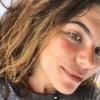 Mariana Goldfarb disse ter melasma no rosto após ser questionada por seguidores sobre mancha na pele