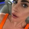 Lady Gaga exibiu estrias nos seios em foto compartilhada no Instagram