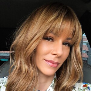 Ana Furtado evitou a queda do cabelo com crioterapia