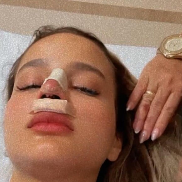 Biah Rodrigues precisou ficar uma noite internada após se submeter a rinoplastia por suspeita de trombose