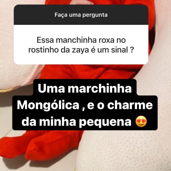 Simone responde internauta sobre mancha roxa no rosto da filha