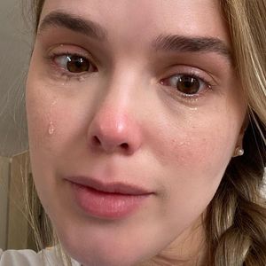 Thaeme Mariôto mostrou o sangramento e garantiu que isso nunca tinha acontecido antes