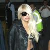Lady Gaga está morando em Chicago para se recuperar da cirgurgia no quadril